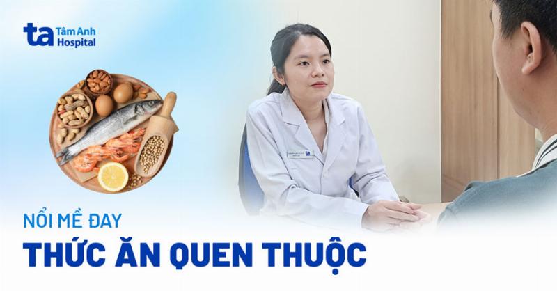 Cac loai thuc pham thuong gay di ung can kieng khi bi noi me day tu tom, cua, den dau phong